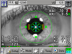 角膜形状解析装置 TMS-5 画像