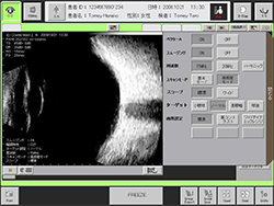 超音波画像診断装置　UD-8000 画像